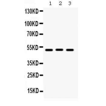 BMP5 Antibody (aa332-365)