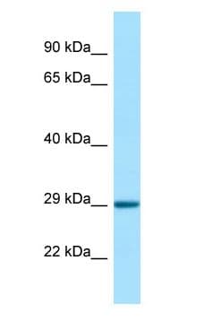 STC1 / Stanniocalcin Antibody (C-Terminus)