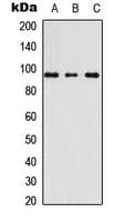 AKAP110 / AKAP3 Antibody (Internal)