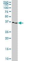 TWF1 / PTK9 Antibody (clone 1E2)