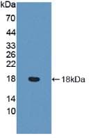 VWF / Von Willebrand Factor Antibody (Biotin)