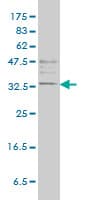 Monoclonal Mouse anti-Human TPSAB1 / Mast Cell Tryptase Antibody (clone 2A10-B5, IHC, WB)