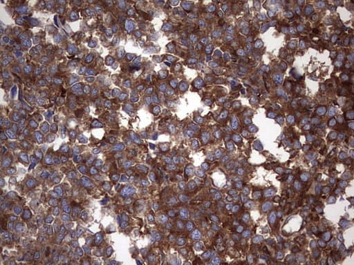 NUMB Antibody (aa1-365, clone OTI1B5)