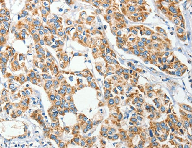 IFT74 / CCDC2 Antibody