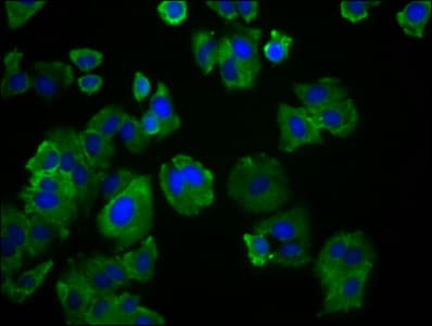 Polyclonal Rabbit anti-Human SLC19A3 Antibody (IF, WB)