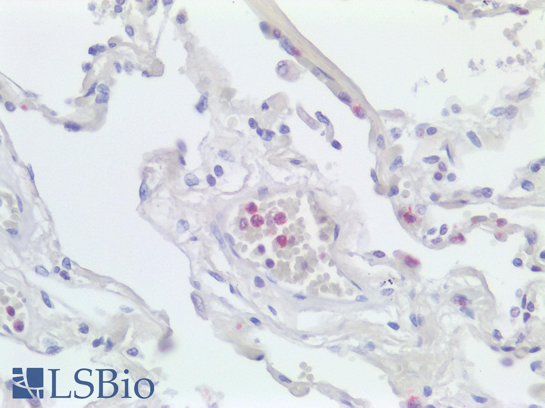 LILRA1 / LIR6 Antibody (aa53-102)