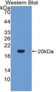 GDF9 / GDF-9 Antibody (aa307-441)