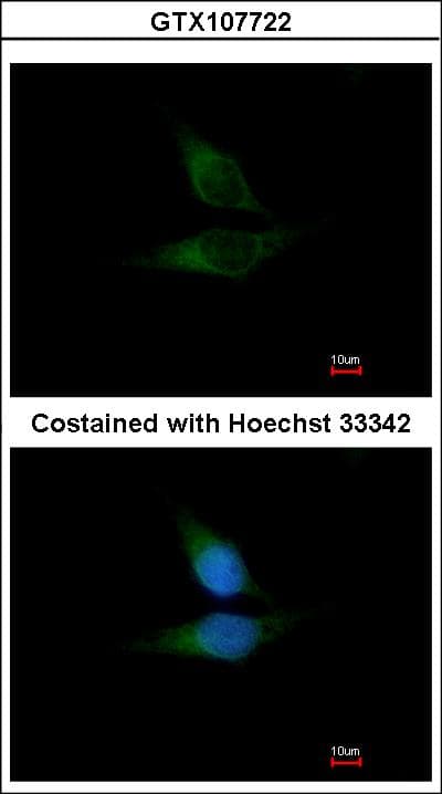 Polyclonal Rabbit anti-Human OSBPL1A / ORP1 Antibody (aa888-950, IHC, WB)