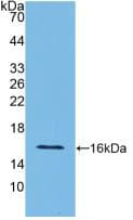 Rat IFN Gamma / Interferon Gamma Protein (Recombinant His, N-Terminal)