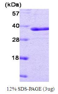 Human PTP1B Protein (Recombinant)