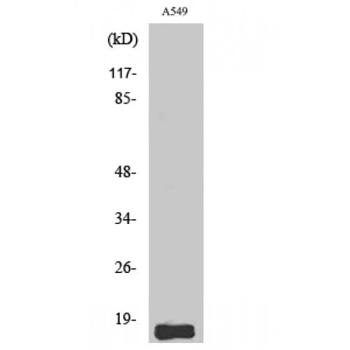Polyclonal Rabbit anti-Human SST / Somatostatin Antibody (10-90 aa, N-terminal, IHC, WB)
