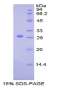 Human F9 / Factor IX Protein (Recombinant His)