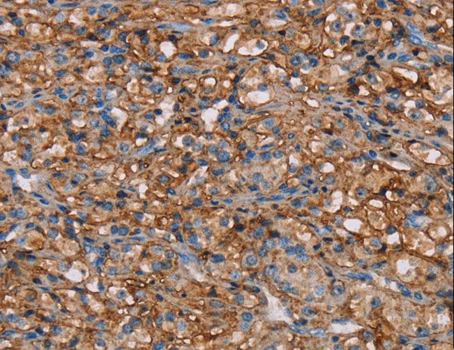 NEDD4L / NEDD4-2 Antibody