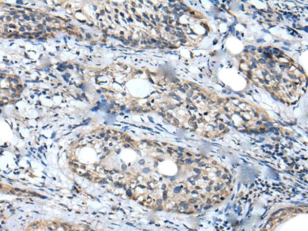 Polyclonal Rabbit anti-Human WDFY2 Antibody (IHC, WB)