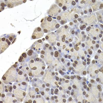 LAMB2 / Laminin Beta 2 Antibody