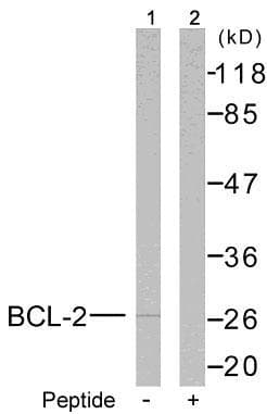 Polyclonal Rabbit anti-Human BCL2 / Bcl-2 Antibody (p56, IHC, WB)