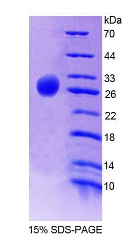 Human FLRT2 Protein (Recombinant His-T7)
