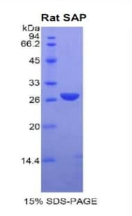 Rat APCS / Serum Amyloid P / SAP Protein (Recombinant His)