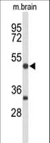 MEF2A / MEF2 Antibody (aa453-479)