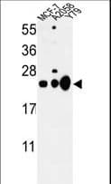 CBX1 / HP1 Beta Antibody (aa128-155)