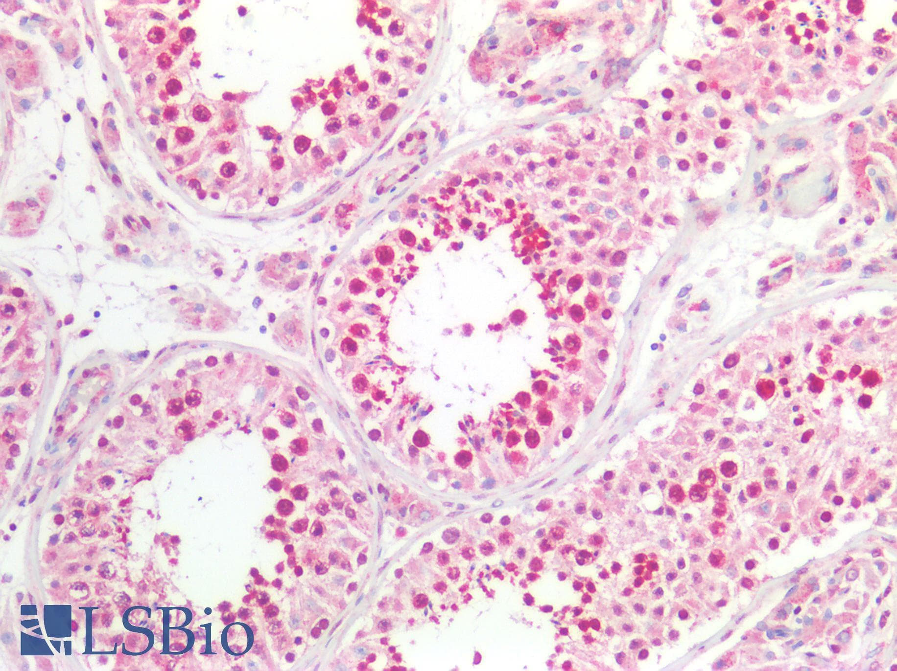 PathPlus™ CX3CL1 / Fractalkine Antibody
