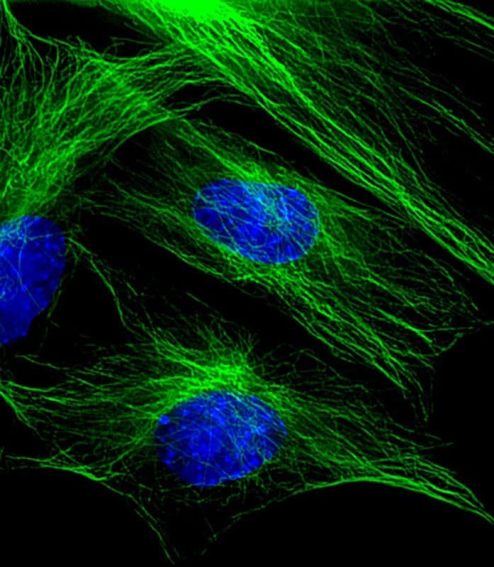 Tubulin beta-5 chain Antibody