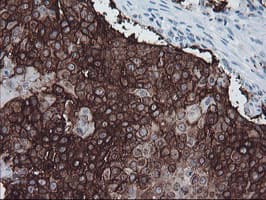 FXYD3 Antibody (clone OTI1F12)