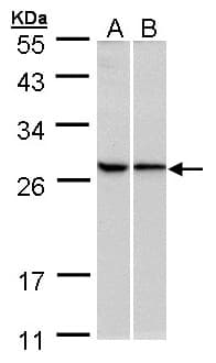 Polyclonal Rabbit anti-Human RPL13A Antibody (aa1-203, IHC, WB)