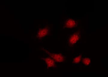 Polyclonal Rabbit anti-Human PIP5K1C Antibody (IF, WB)