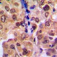 Polyclonal Rabbit anti-Human RDM1 Antibody (Internal, IHC, WB)