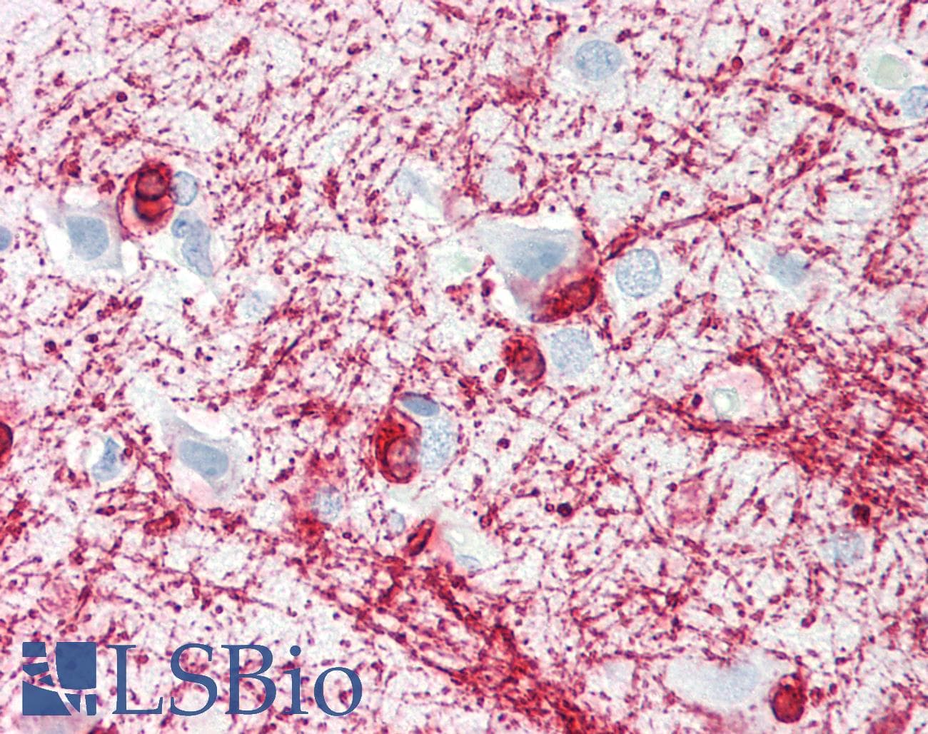 PathPlus™ MBP / Myelin Basic Protein Antibody (clone ABT-MBP)