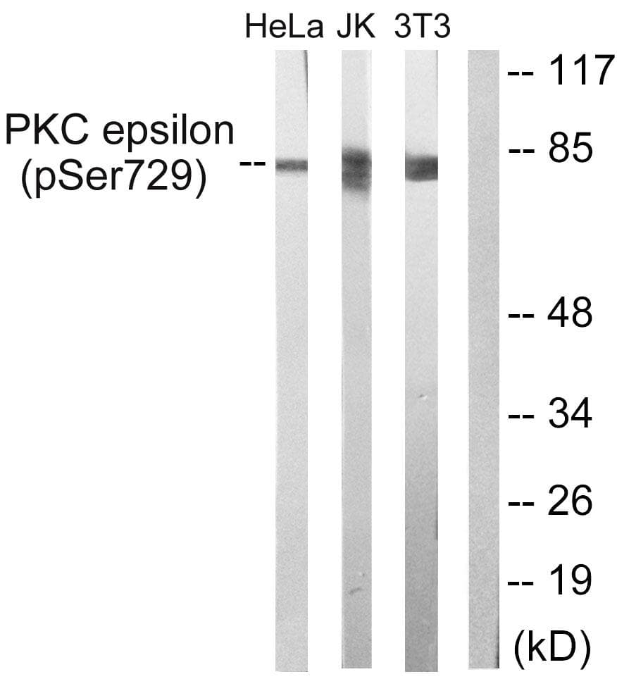 Polyclonal Rabbit anti-Human PRKCE / PKC-Epsilon Antibody (phospho-Ser729, WB)