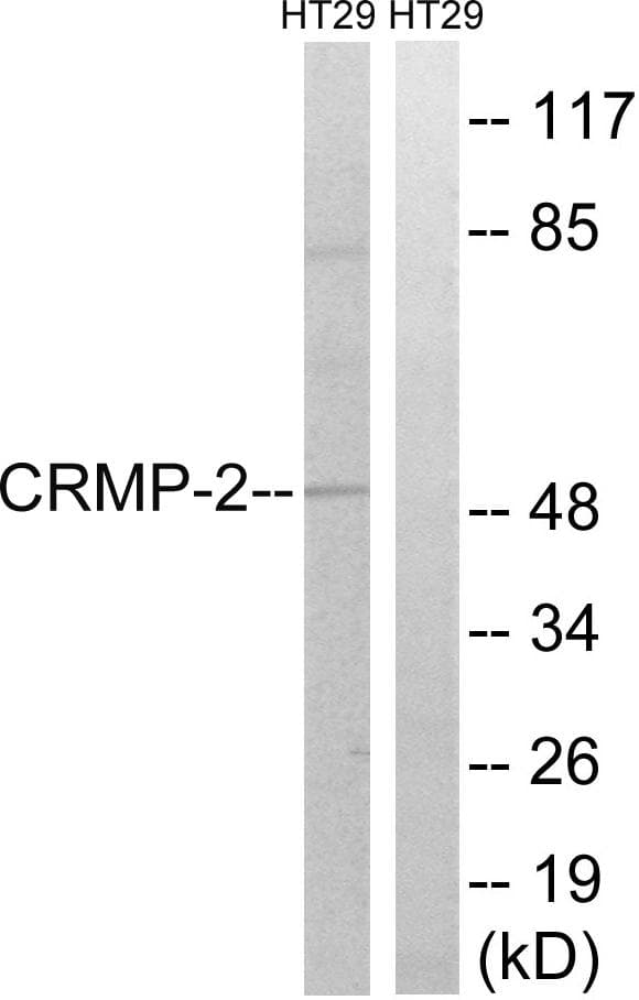 DPYSL2 / CRMP2 Antibody (p509)