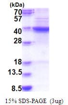 Human FDFT1 / Squalene Synthase Protein (Recombinant His)