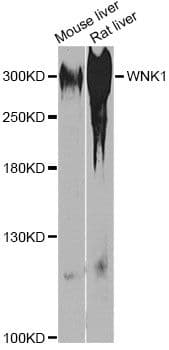 Polyclonal Rabbit anti-Human WNK1 Antibody (WB)