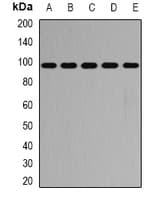 PathPlus™ GPBB / PYGB Antibody