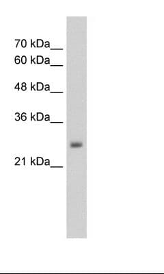 NSMF / NELF Antibody (aa283-332, HRP)