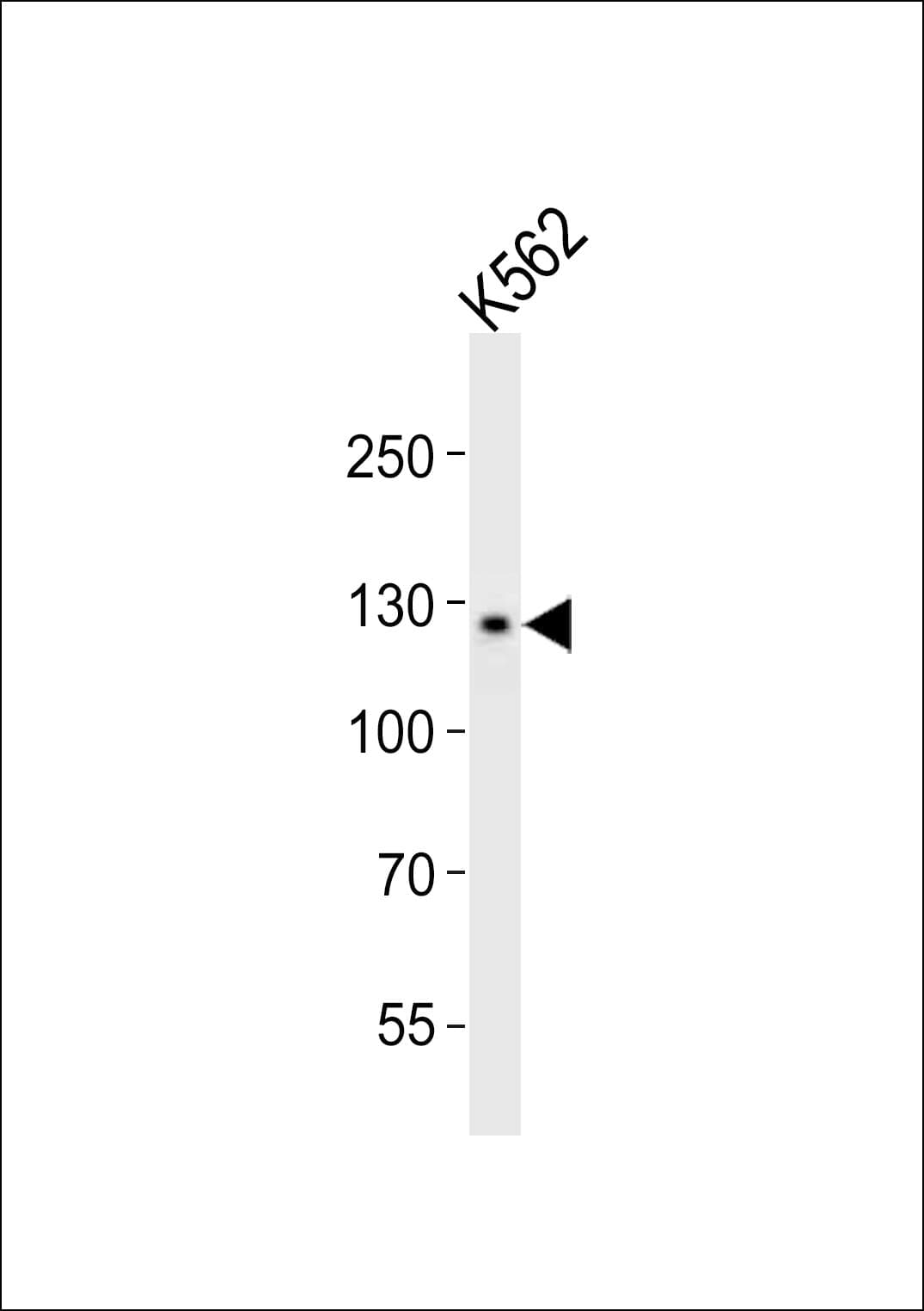 IHC-plus™ Polyclonal Rabbit anti-Human CD118 / LIF Receptor Alpha Antibody (aa1021-1055, IHC, WB)