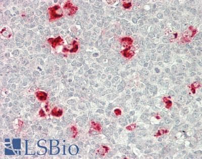 IHC-plus™ Polyclonal Rabbit anti-Human USP15 Antibody (aa960-C-term, IHC, WB)