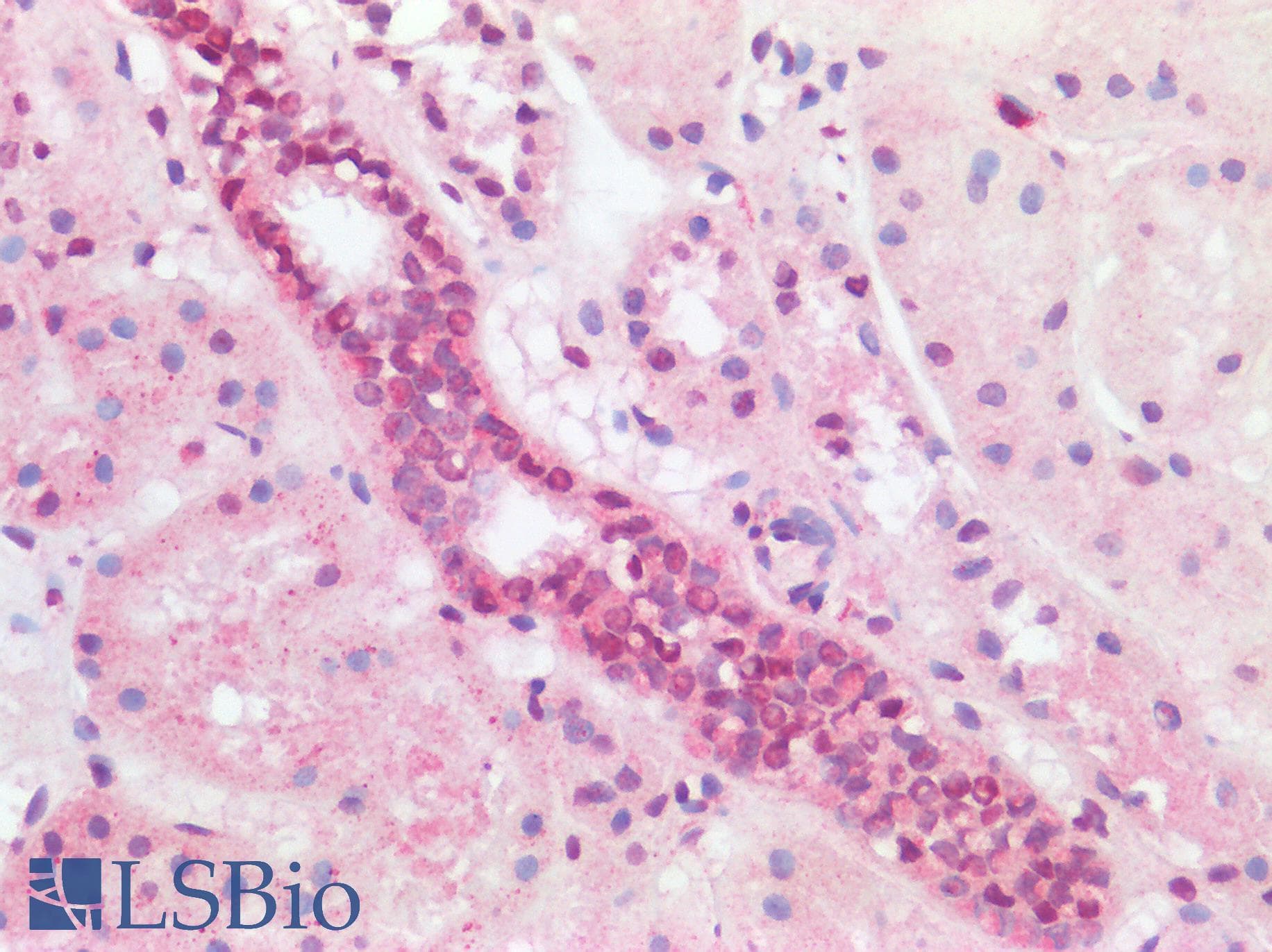 IHC-plus™ ABL1 / c-ABL Antibody (aa850-900)