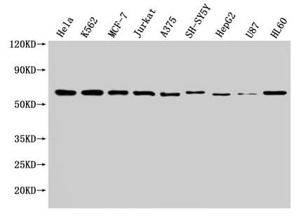 Polyclonal Rabbit anti-Human NOP58 / NOP5 Antibody (WB)
