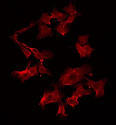 TTC23 Antibody