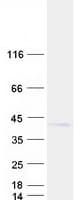 Human B4GALT7 Protein (Recombinant Myc-DDK (Flag))