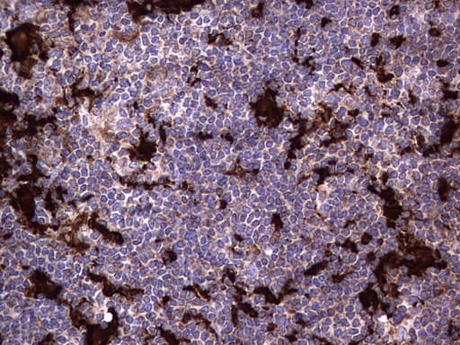 Monoclonal Mouse anti-Human MTDH / Metadherin Antibody (clone OTI2H4, aa70-582, IHC, WB)