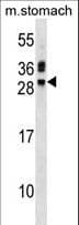 TNNI3 / Cardiac Troponin I Antibody (aa86-114)