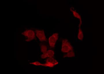 Polyclonal Rabbit anti-Human CDK2 Antibody (phospho-Thr160, IHC, IF, WB)