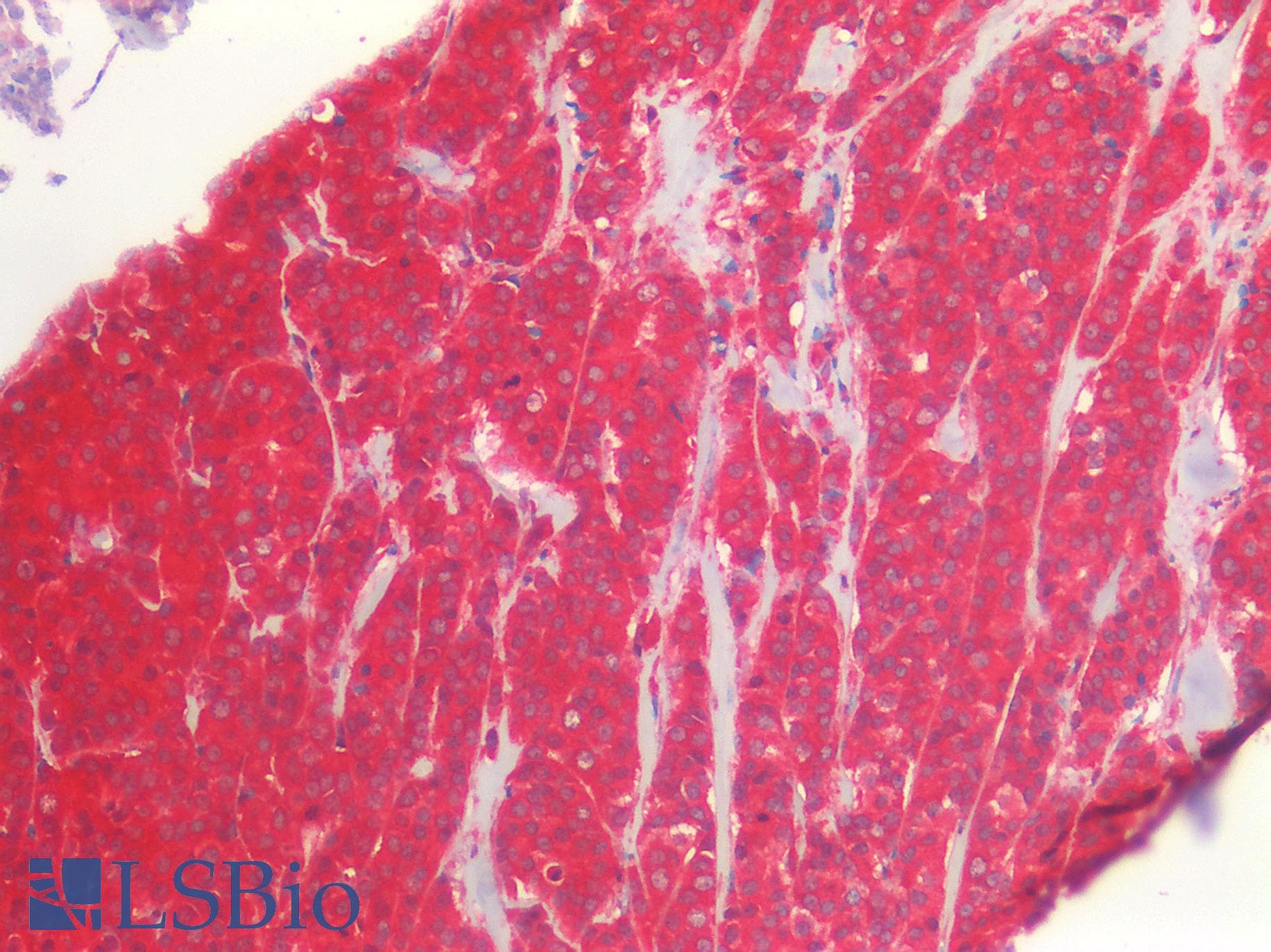 IHC-plus™ Polyclonal Rabbit anti-Human ERBB2 / HER2 Antibody (IHC)