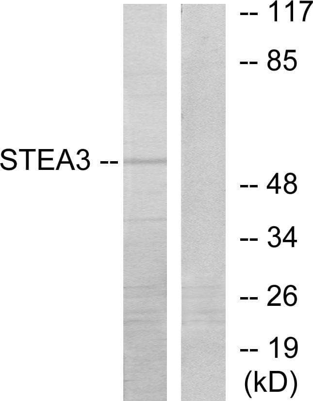 Polyclonal Rabbit anti-Human TSAP6 / STEAP3 Antibody (IF, WB)