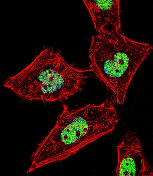 IHC-plus™ Polyclonal Rabbit anti-Human RORA / ROR Alpha Antibody (Thr216, IHC, IF, WB)