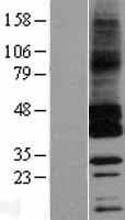 GPRC5C Protein (Over-Expression Lysate Myc-DDK (Flag))